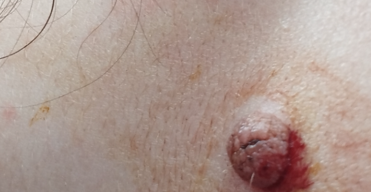 Request assistance for an urgent procedure