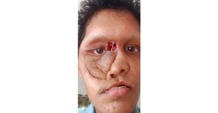 Cancer Patient Tariq
